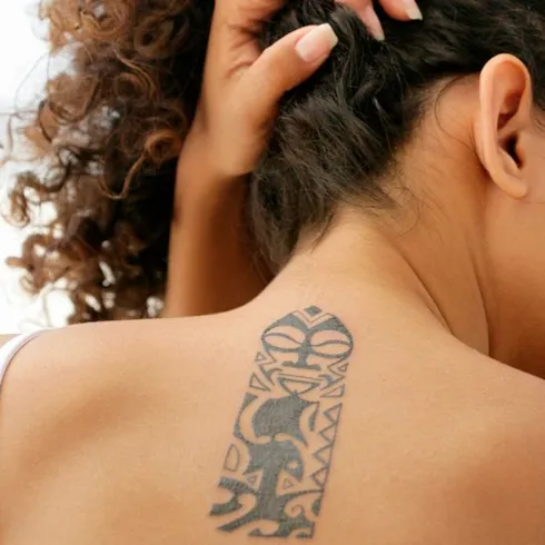 Tattoo & Pigment Removal